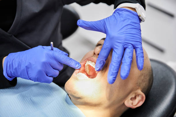 Best Emergency Treatment for Toothache in Hebron, MD